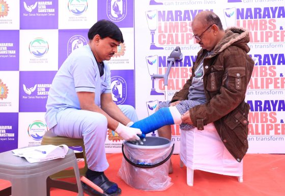 Free Narayan Artificial Limb & Calipers Fitment Camp